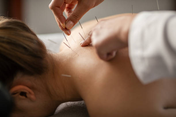 Acupuncture-Charlotte-NC